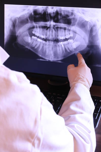 Best Dentist for Tooth Abscess  in Montgomery, PA