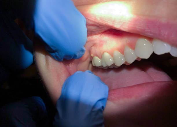 Best Dentist for Dental Trauma  in Montgomery, PA